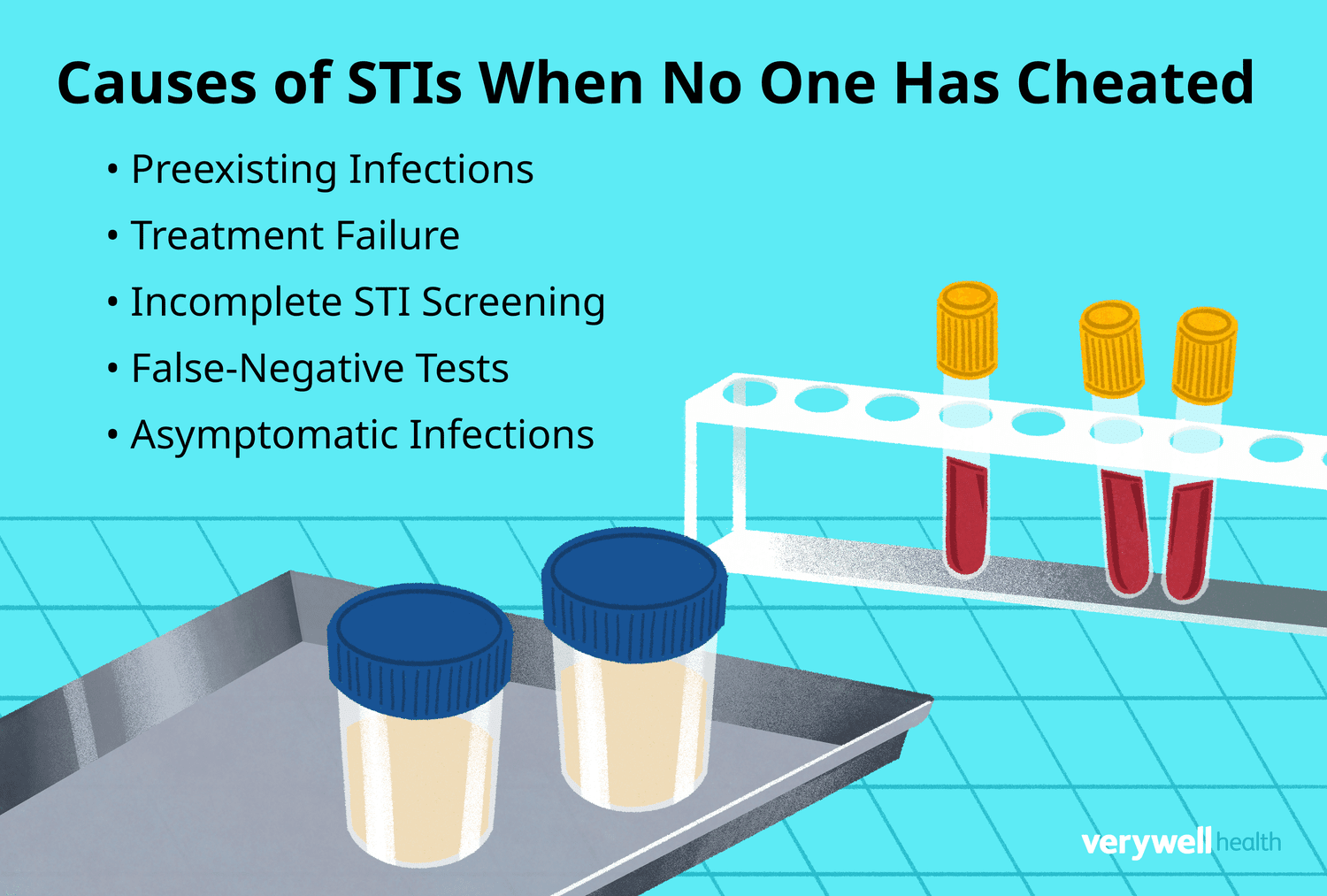 Is it true, can you get chlamydia drinking after someone else? Understand the real transmission risks of this STI.