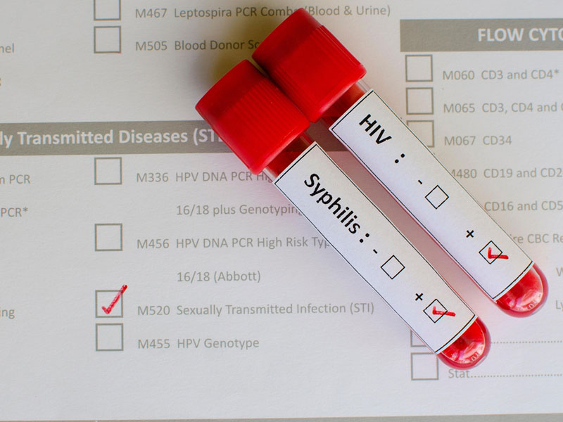 If your main question is does bcbs cover std testing, heres how to understand your benefits for these tests.