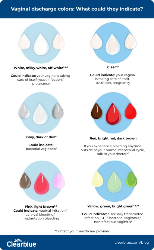 Got flujo blanco lechoso sin olor? Find out what this specific type of discharge really means.