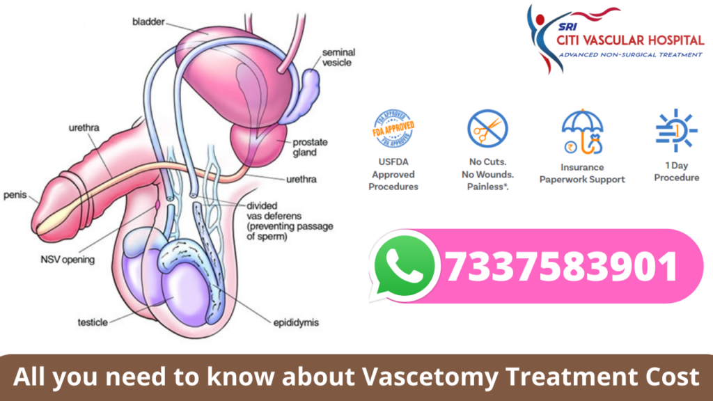 Male vasectomy price: how much does it usually vary? (Factors that make the final cost different)
