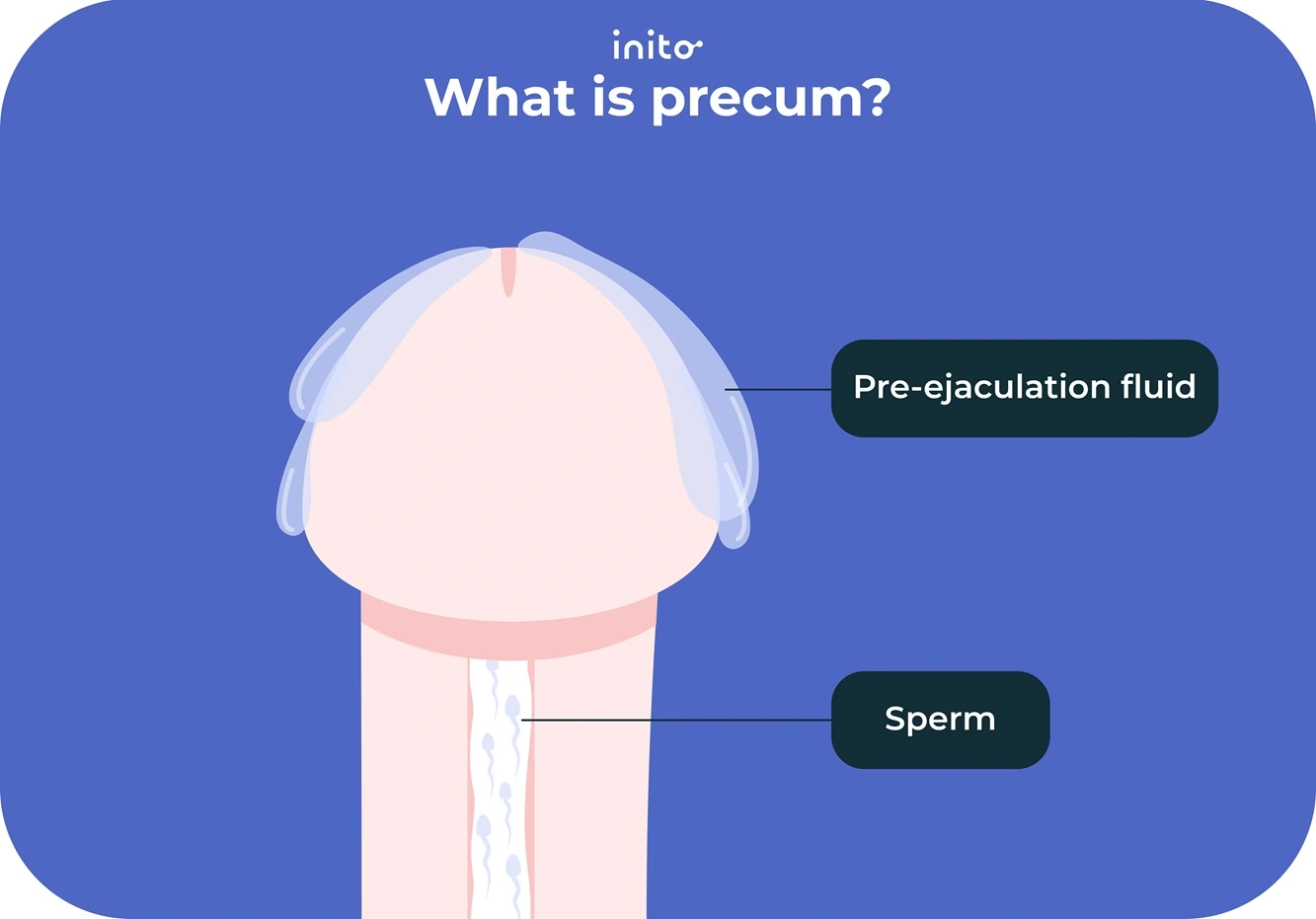 Will el liquido preseminal embaraza always happen? Debunking common myths about pre-ejaculate and fertility.