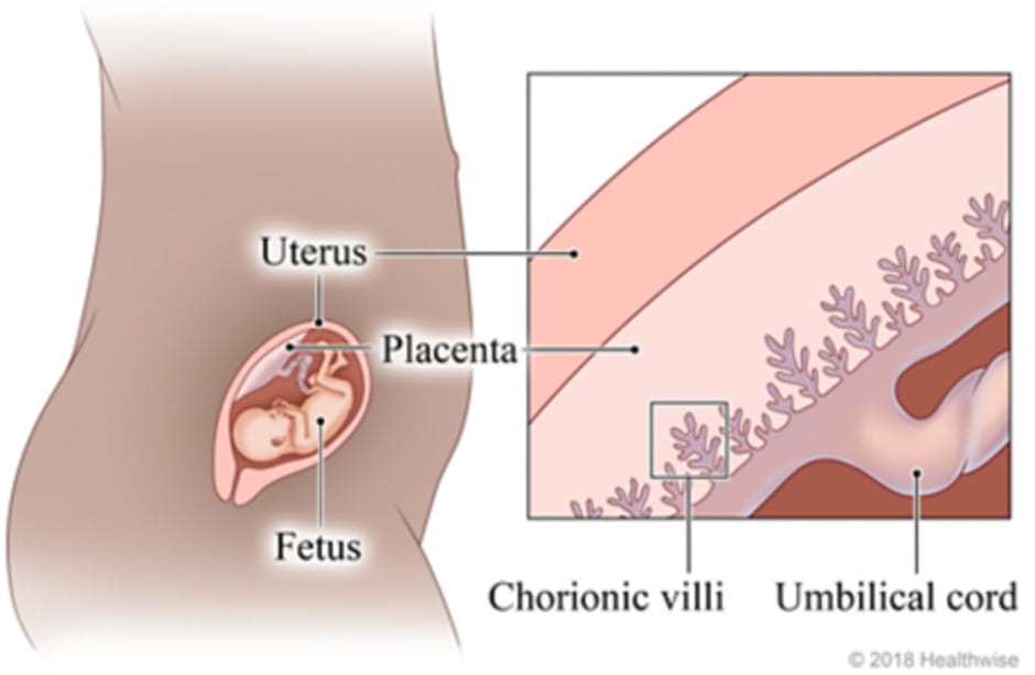 Chorionic Villus Sampling Near Me: Find Local CVS Options Now