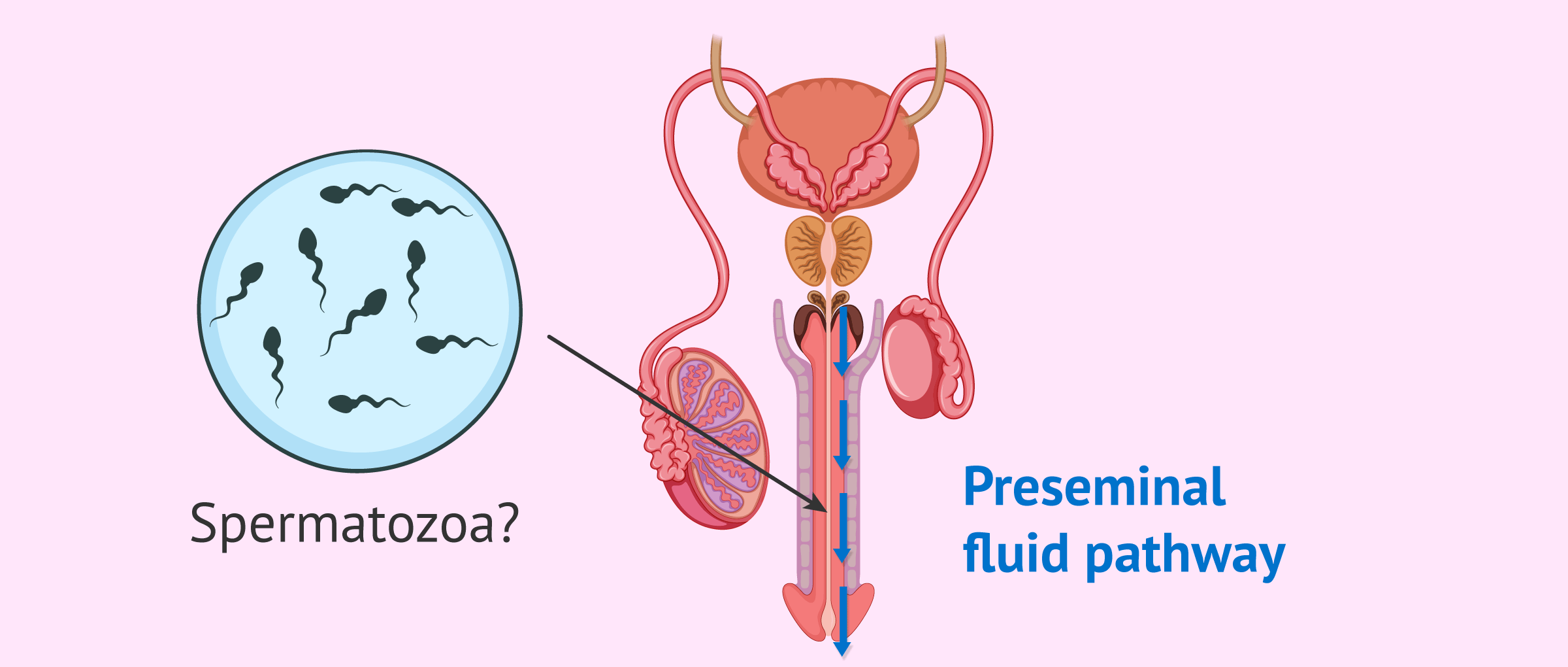 Will el liquido preseminal embaraza always happen? Debunking common myths about pre-ejaculate and fertility.