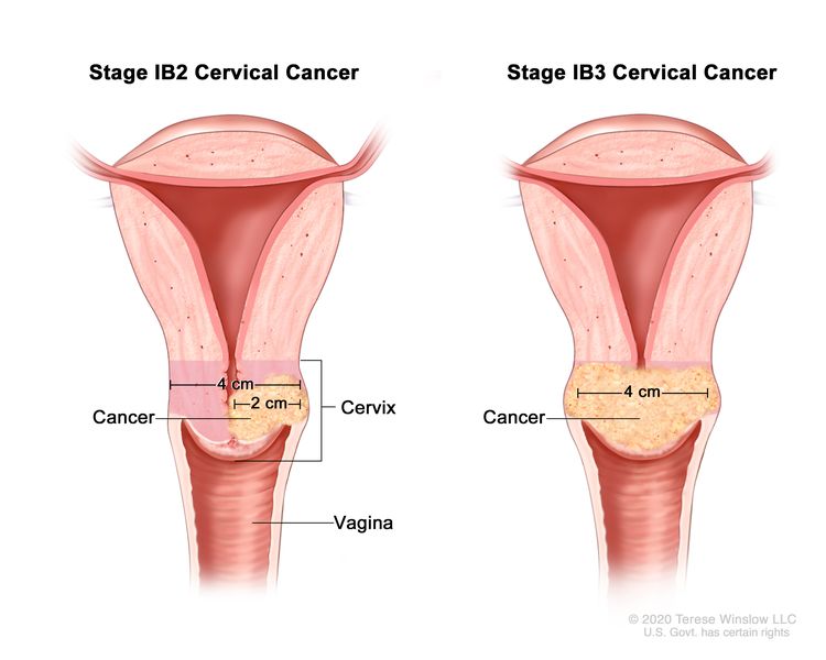 What do pictures of cervix really show you? Learn easy ways to understand your cervical health.