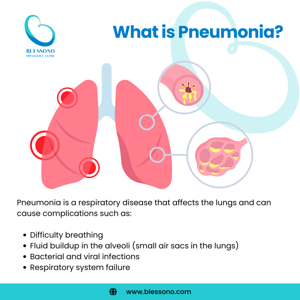 AIDS Induced Pneumonia Risk Factors Are You Protecting Yourself Enough