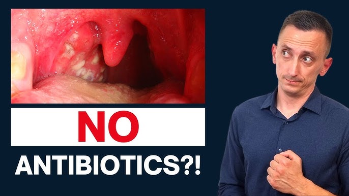 Need how do you say strep throat in spanish? Get the medical term fast!