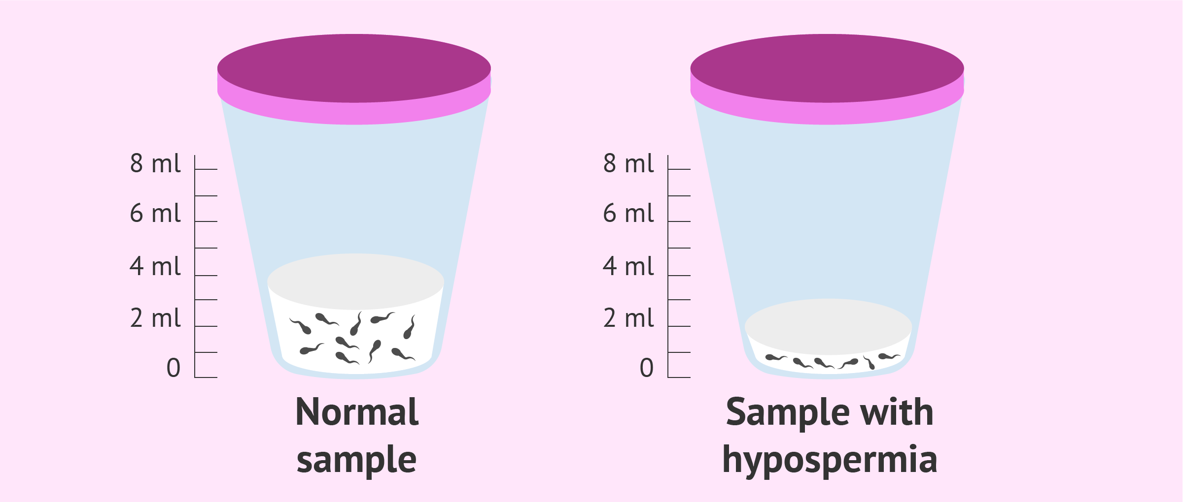 Less Semen After Sex 6 Common Reasons Men Ejaculate Very Little
