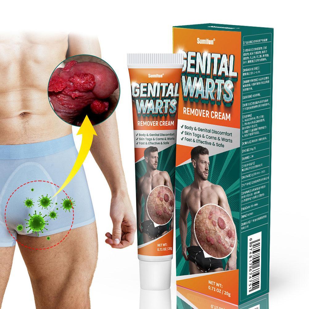 How to Use Genital Warts Cream? Learn How to Remove Genital Warts Fast!