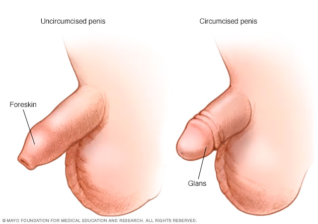 pics of uncircumcised penises anatomy visual help for mens health needs