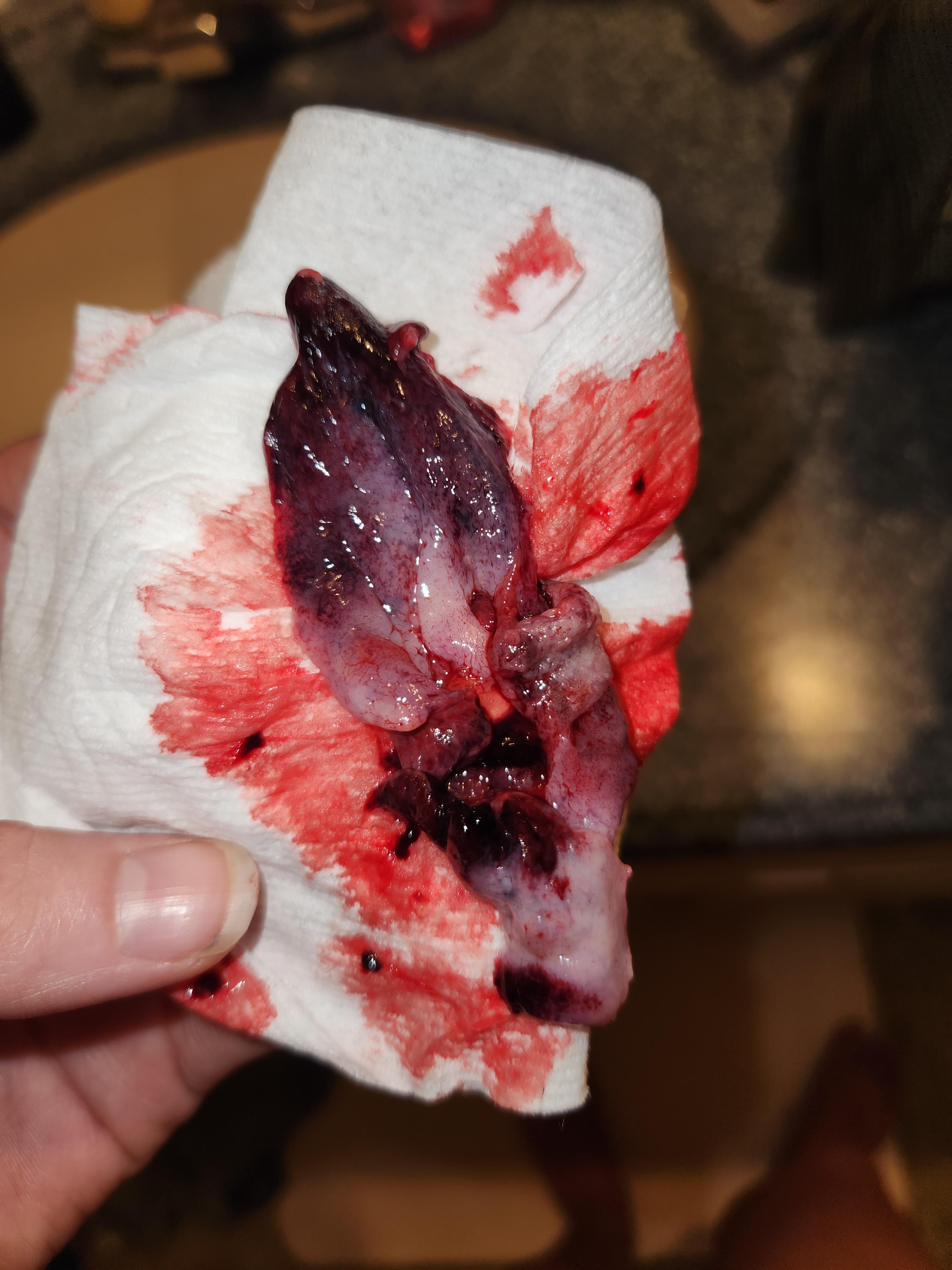 7 weeks pregnant miscarriage pictures need help understanding these photos