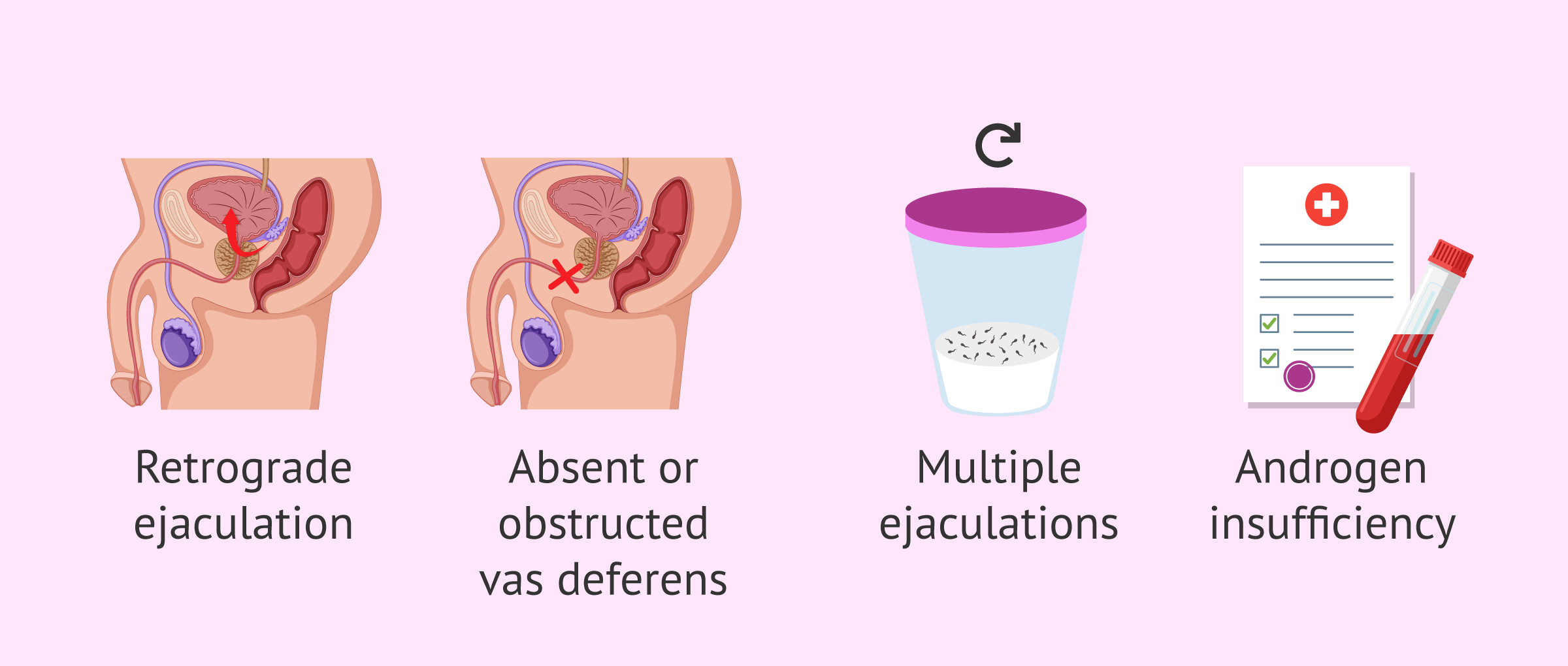 Less Semen After Sex 6 Common Reasons Men Ejaculate Very Little