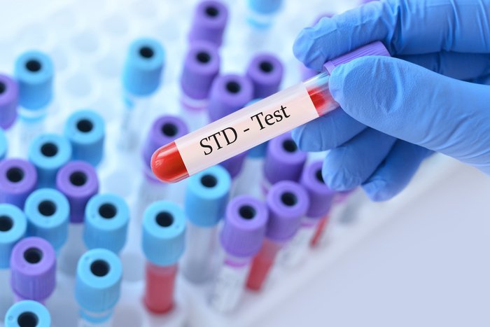 Free STD Testing Miami Dade Compare Types and Clinics Nearby