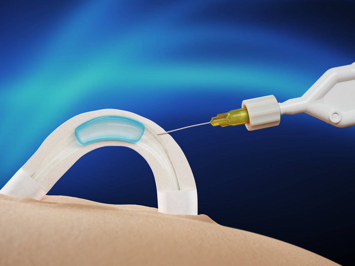Contraceptive Injection for Men Explained How Effective Is Male Birth Control Shot