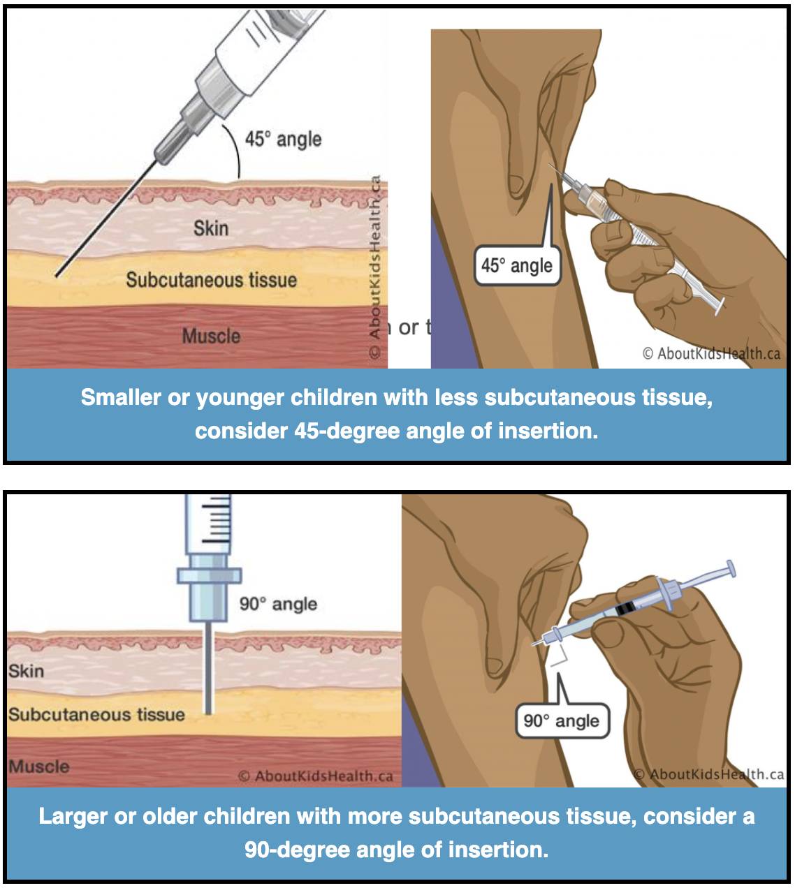 Quick Tips for SC Injection Needle Size Selection & Comfort