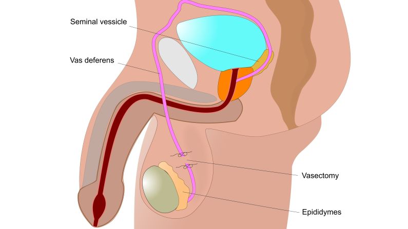 Contraceptive Injection for Men Explained How Effective Is Male Birth Control Shot