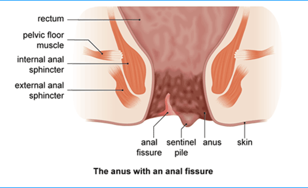 How I Managed My First Anal Experience Tips To Avoid Pain