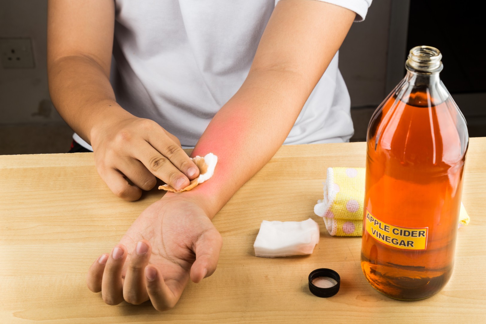 Home Remedies for Aradores En La Piel Get Itchy Skin Relief Now