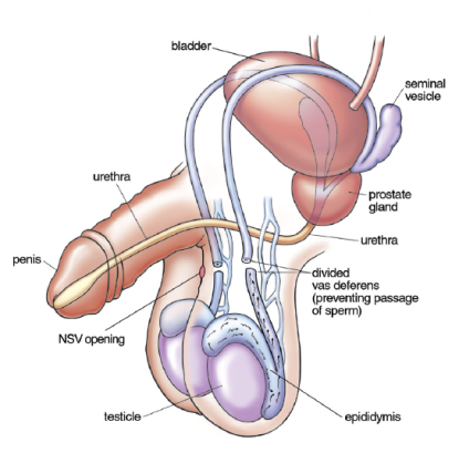 How Soon Can I Schedule Vasectomy Near Me (Clinics With Openings)