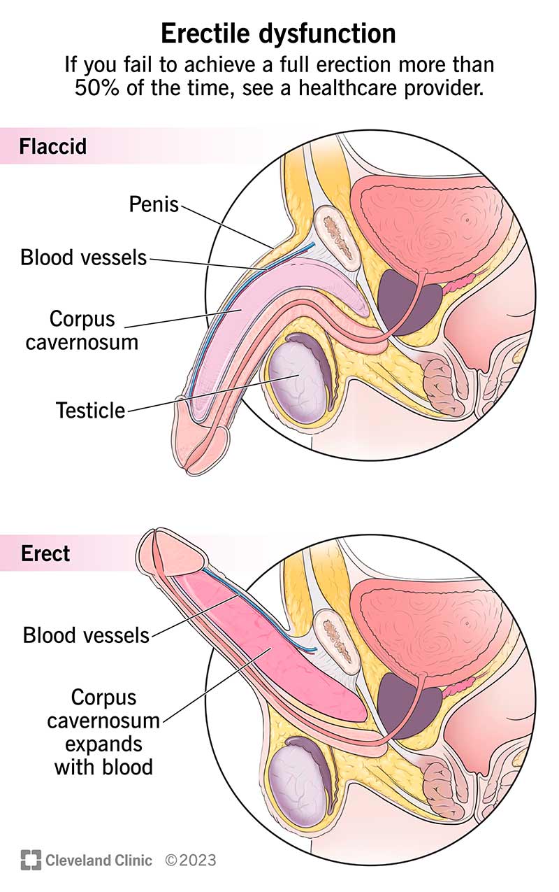 Pee Boner Troubles? Learn 4 Safe Prevention Tips Today