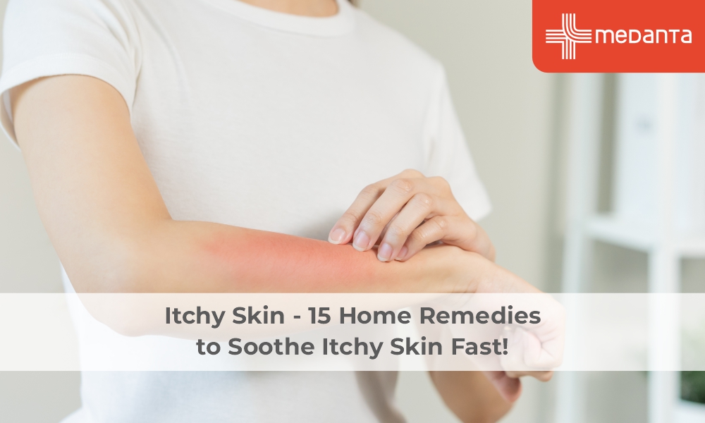 Home Remedies for Aradores En La Piel Get Itchy Skin Relief Now