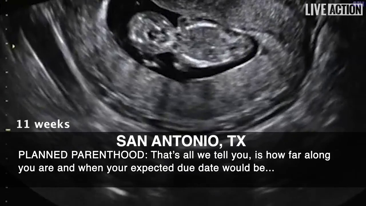 Does Planned Parenthood Do Ultrasounds For Free Call This Number To Verify Costs First