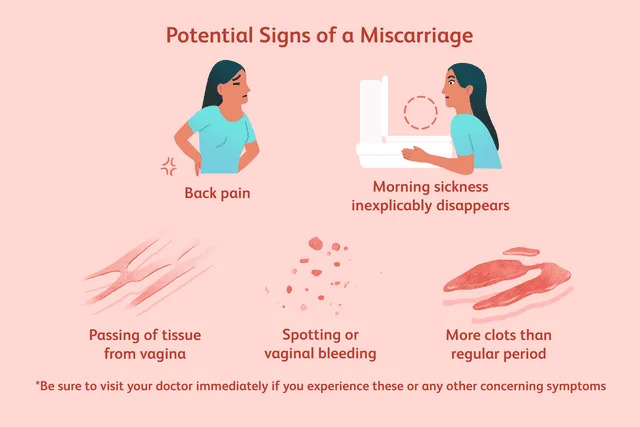 Miscarriage Early Pictures - Spot Important Symptoms and Signs Now