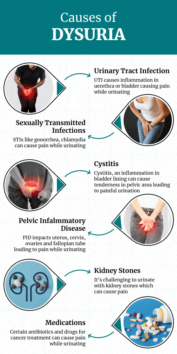 Urinary Pain: Could It Be UTI or Chlamydia? Find Out Now.