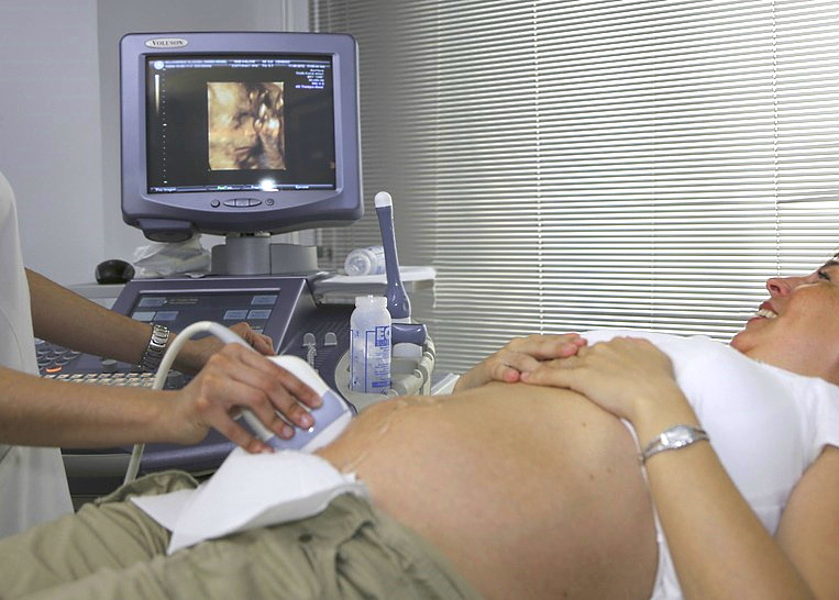 Does Planned Parenthood Do Ultrasounds For Free Call This Number To Verify Costs First