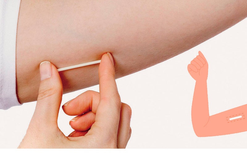 Irregular Bleeding After Implanon Out? How Long Does First Period Take?