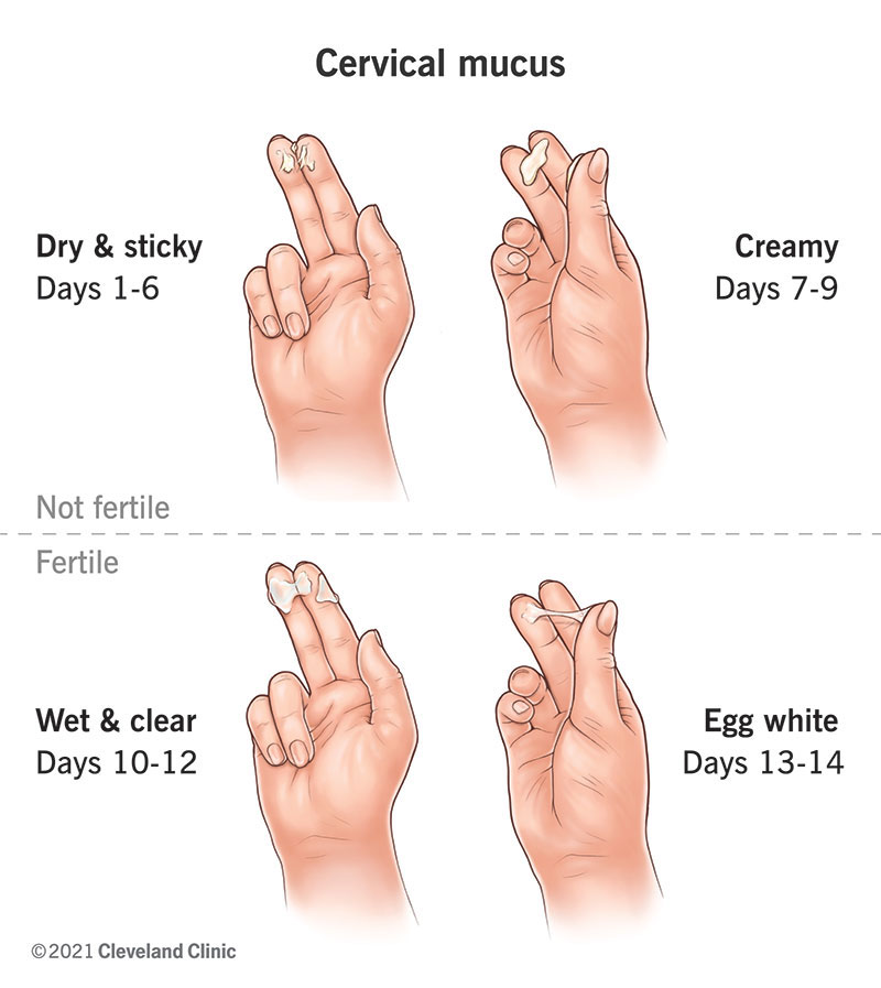 Is Creamy White Discharge Normal? Learn Common Causes & Solutions
